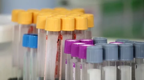 Putting Empty Plastic Vials in Case Stock Footage 61334494