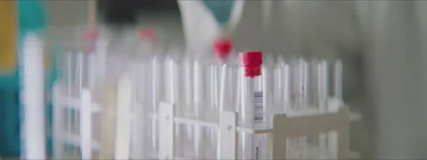 Putting test tube into stand Video stock 147615377