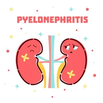 Pyelonephritis kidneys poster Stock Illustration