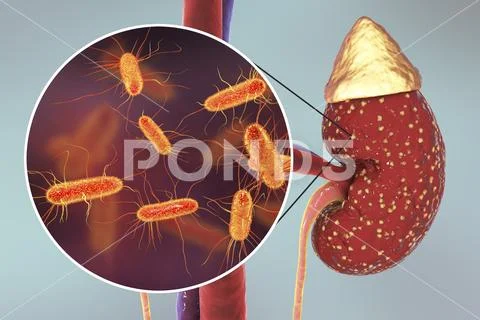 Pyelonephritis, medical concept, and close-up view of bacteria Stock Illustration