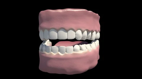 Pyorrhea 動画素材 121398821