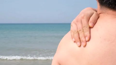 Question mark drawn by sunscreen on male back close-up, skin protection concept. Stock Footage 311041769