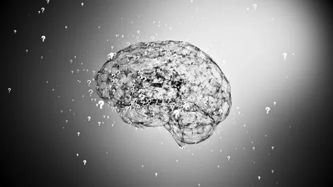 Questioning Brain 02 Stock Footage 305630203