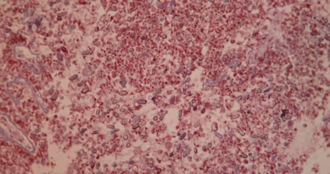 Rabbit cocticitis of the liver Stock Footage 144924030