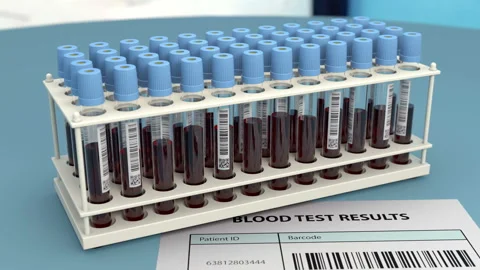 Rack with blood samples in research laboratory Stock Footage 128306041