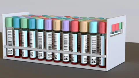 A rack of blood test tubes Stock Footage 59703765