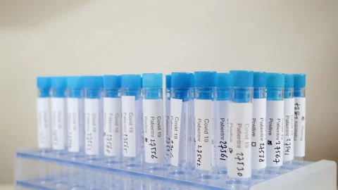 Rack of Covid19 test tubes with positive results. Stock Footage 142232941