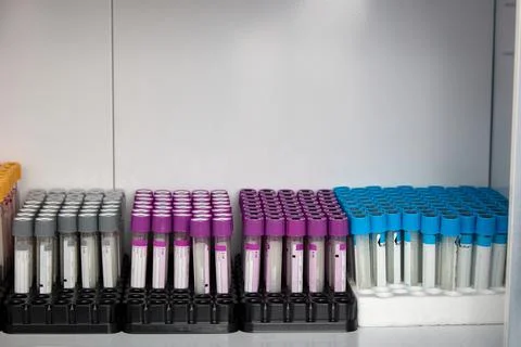 Rack with empty vacuum tubes with lids different color for laboratory blood test Foto stock
