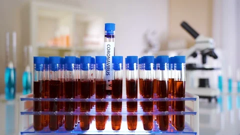 A rack of test tubes with the sample kits of the COVID-19 coronavirus Stock Footage 127947215