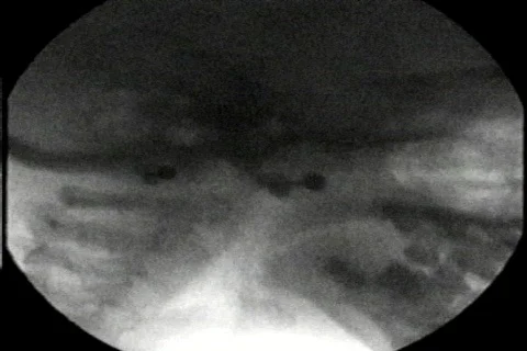 Rad Lasers Stock Footage 135905