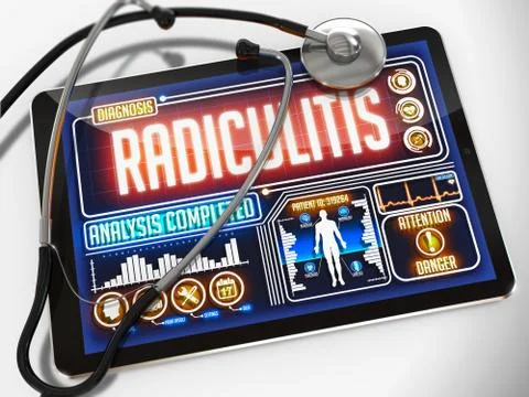 Radiculitis on the Medical Tablet. Illustrazione stock