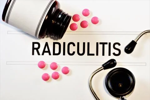 Radiculitis. Stock Photos