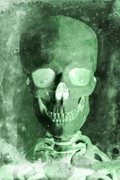 Radiogram of a Human Skull Stock Photos