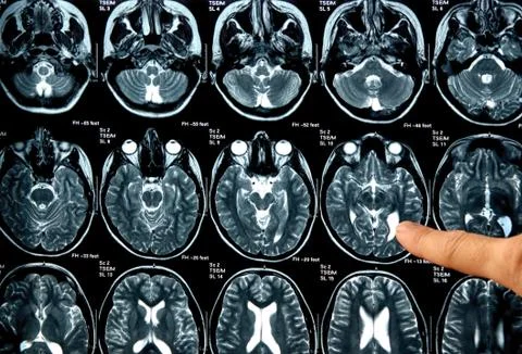 Radiograph Stock Photos