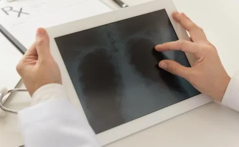 Radiograph Stock Photos