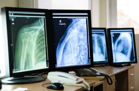 Radiography of human body parts Stock Photos