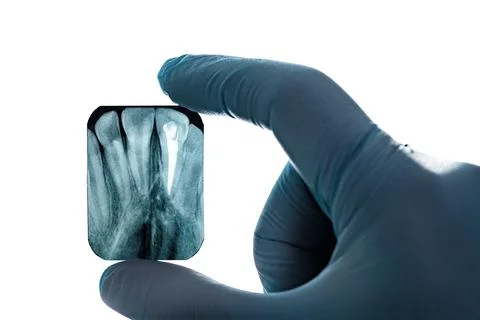 Radiography imaging upper canines root canal hand in glove isolated Stock Photos