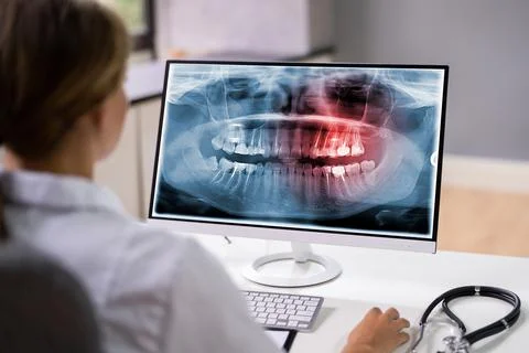 Radiologist Dentist Using X Ray Software Stock-Fotos
