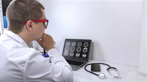 A radiologist doctor examines the result of a computed tomography of the brain o Video stock 129898254