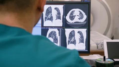 Radiologist looking at monitors with lungs activity results in control room. 4K Stock Footage 122420596