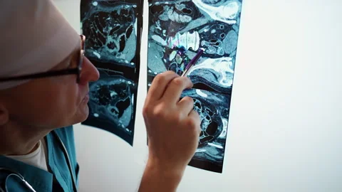 A radiologist in the process of establishing a diagnosis. Stock Footage 310228775