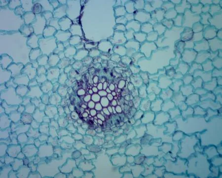 Ranunculus Root: Eudicot Primary Structure Stock Photos