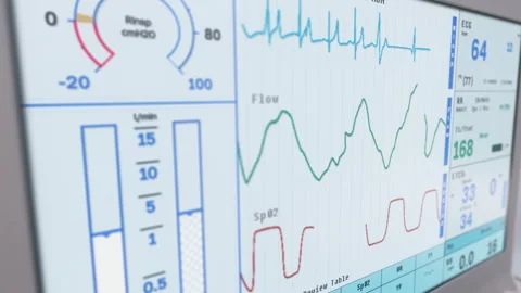 Rapid Decrease In Lung Organ Vital Signs Displayed By Modern\ Medical Machine 库存影片 265914622