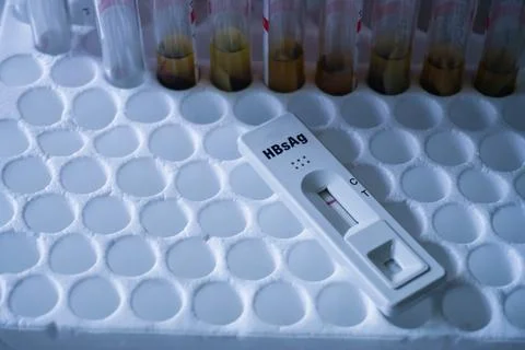 Rapid test cassette for Hepatitis B Virus Test (HBsAg) on a above the red v.. Stock Photos