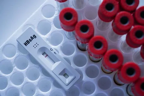 Rapid test cassette for Hepatitis B Virus Test (HBsAg) on a above the red v.. Stock Photos