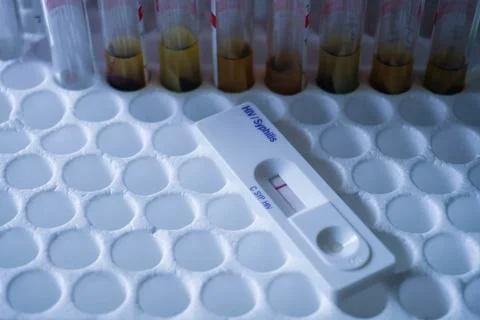 Rapid test cassette of HIV showing negative test result. above the red vacu.. Stock Photos