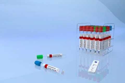 Rapid Test for viral disease Covid -19 nCoV in a Laboratory. Copy Space. 3D I Stock Illustration