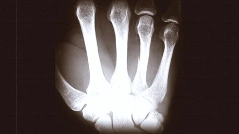 Rapid X-Ray Sequence on Scratched 35mm Sepia Film. Stylized 1930s Vídeo Stock 334660082