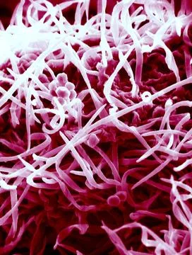  Raspberry, sem This is a scanning electron micrograph showing the epiderm... Stock Photos