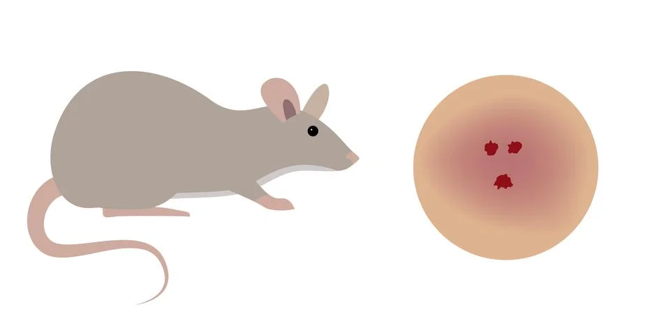 Rat Biting Human Skin Causing Bleeding Wound and Infection Stock Illustration