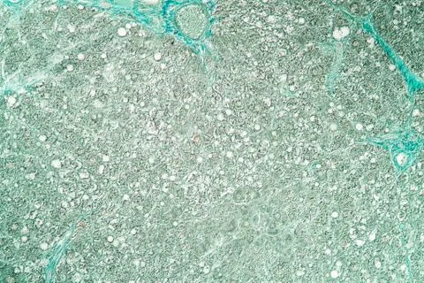 Rattenleber Stock Photos