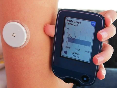 Reading a glucose with device for continuous glucose monitoring in blood – CGM Stock Photos