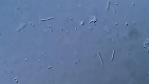 Real Bacteria Sample Viewed Microscopically Stock-Footage 317140750