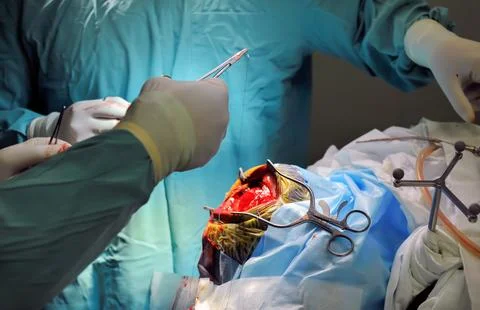 Real brain surgery, two surgeons at work, blue toning Foto stock