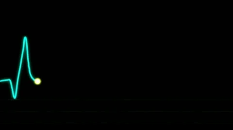 Real EKG screen Stock Footage 10826953