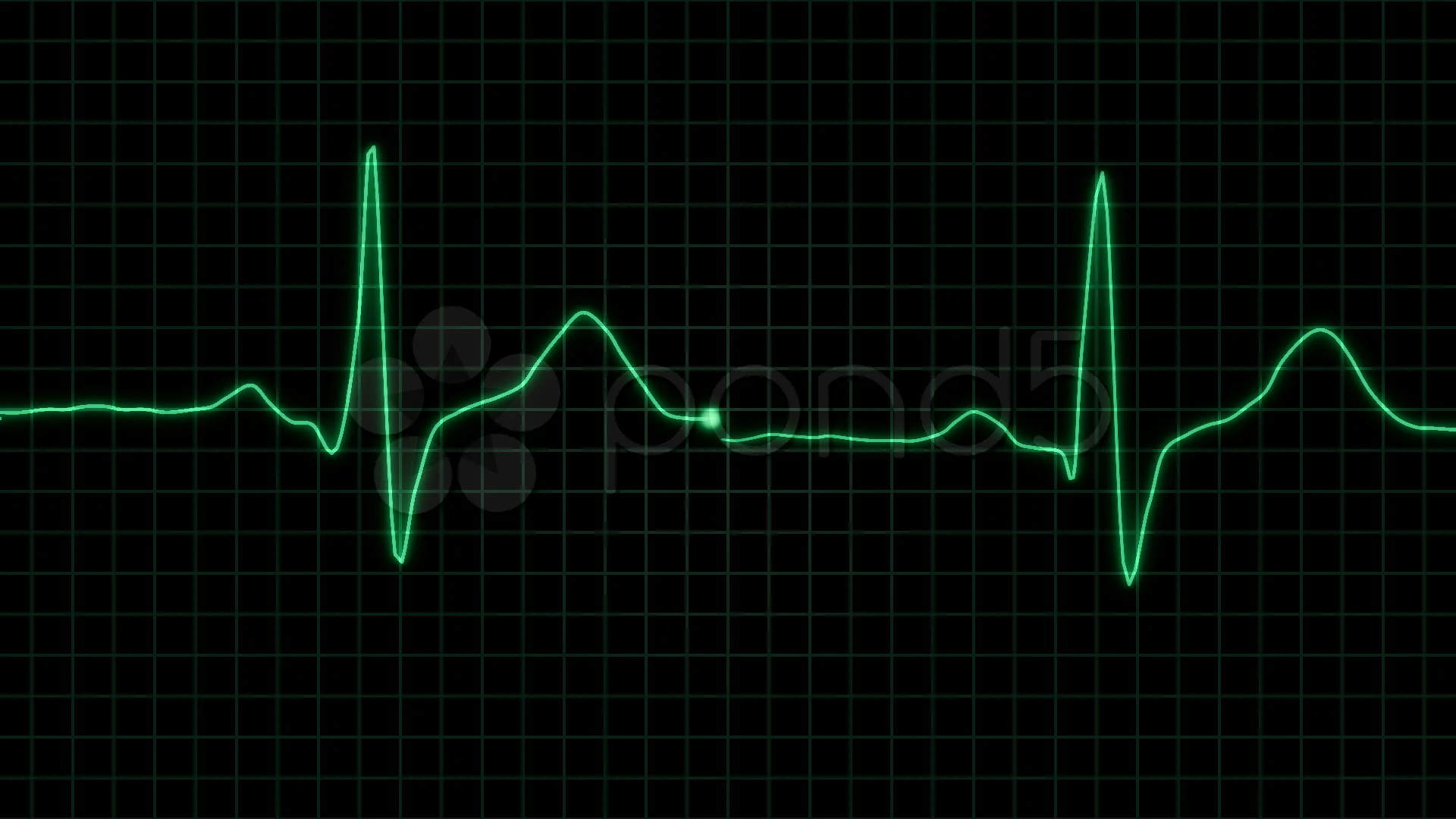 Heart Monitor Flatline Stock Video Footage Royalty Free Heart Monitor Flatline Videos Page 4