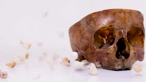Real human skull in a section next to the wisdom teeth of real people serve and Stock Footage 234334828