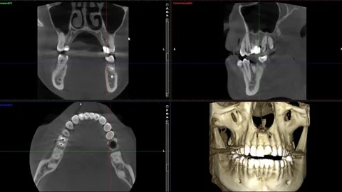Real life MRI scan of man jaws for stomatology dentist research new quality Stock Footage 85230333