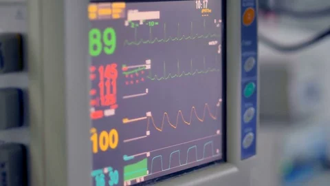 https://images.pond5.com/real-medical-monitor-displays-vital-footage-084161483_iconl.jpeg