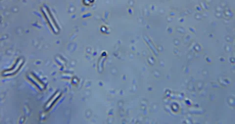 Real microscopic footage capturing living microorganisms in natural fresh Stock Footage 330480880