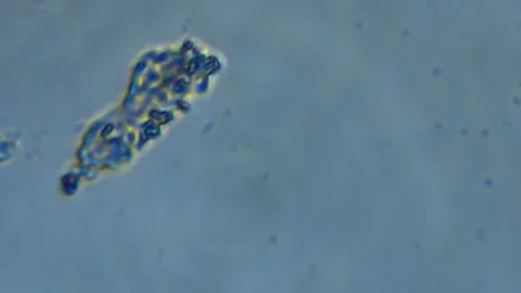 Real microscopic footage capturing living microorganisms in natural freshwater Vídeo Stock 332659844