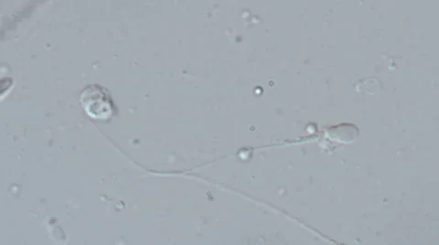 Real sperm footage Video stock 32965363