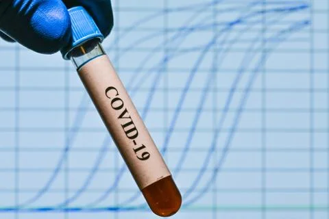 Real-time PCR testing on COVID-19. Stock Photos