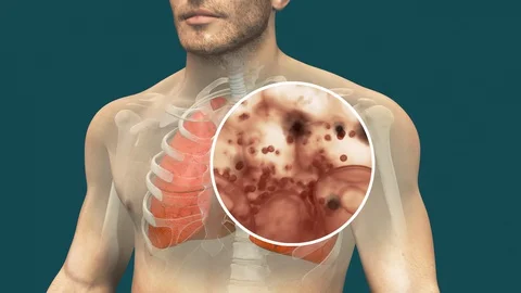 Realistic 3d animation of human lungs infected by coronavirus Stock Footage