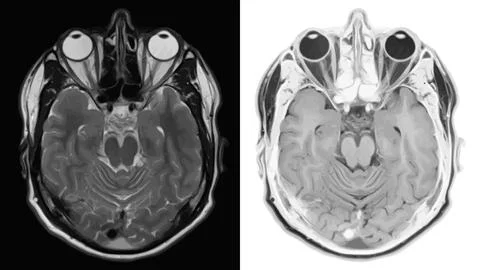 Realistic cross section of brain with CT scan, MRI Magnetic resonance imaging Stock Illustration