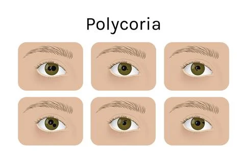 Realistic human eyes with polycoria vector illustration design Stock Illustration